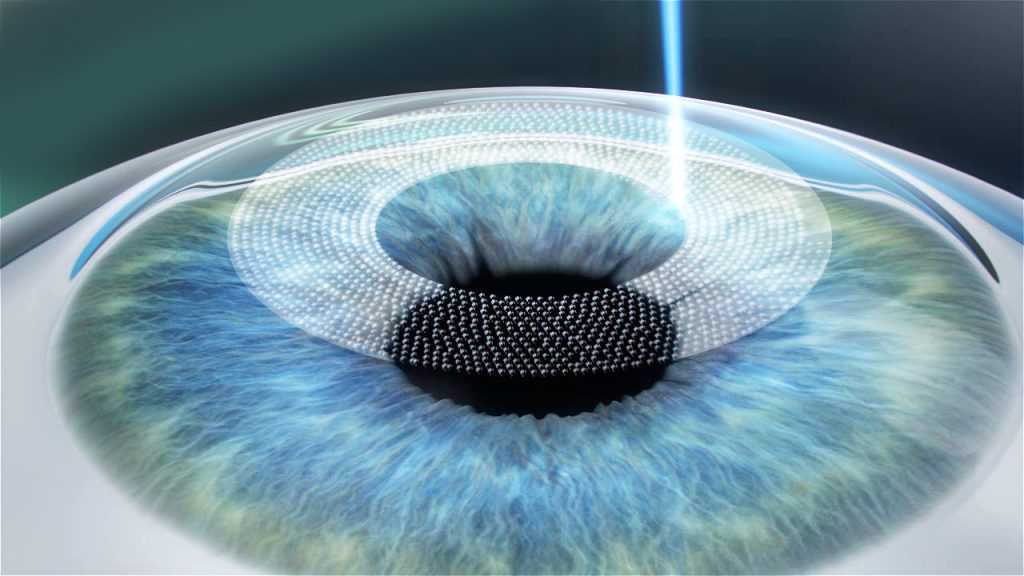 Peste 3700 de operaţii de cataractă, finanţate din fondurile de asistenţă medicală